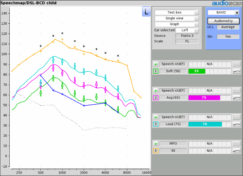 Speechmap - Verifit Skull Simulator